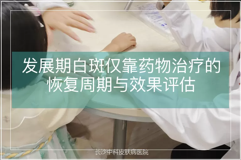 发展期白斑仅靠药物治疗的恢复周期与效果评估