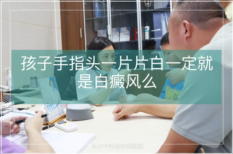 孩子手指头一片片白一定就是白癜风么