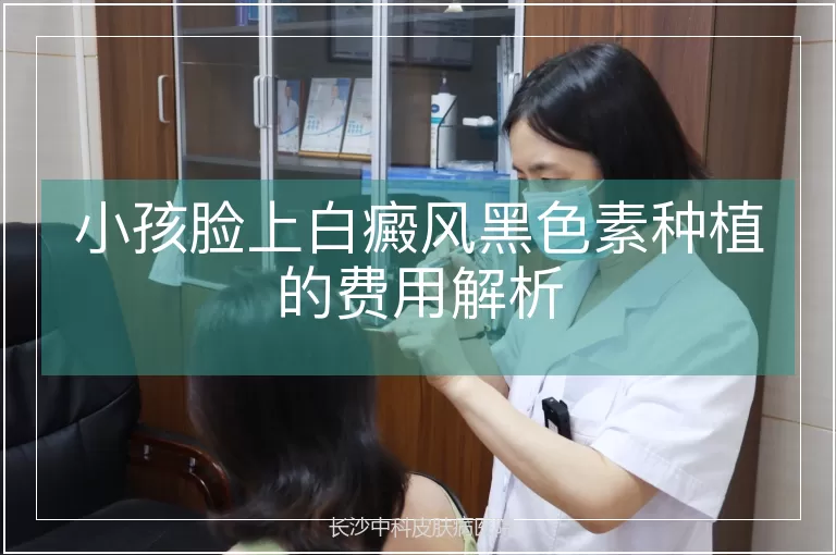 小孩脸上白癜风黑色素种植的费用解析