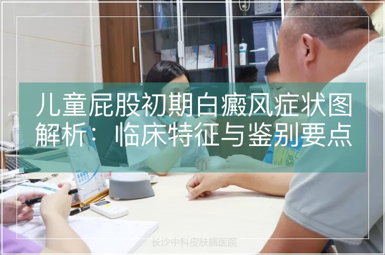 儿童屁股初期白癜风症状图解析：临床特征与鉴别要点