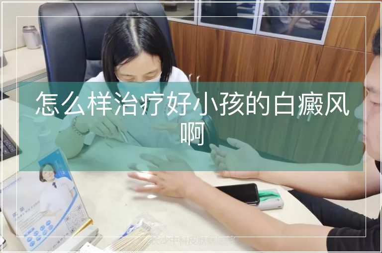 怎么样治疗好小孩的白癜风啊