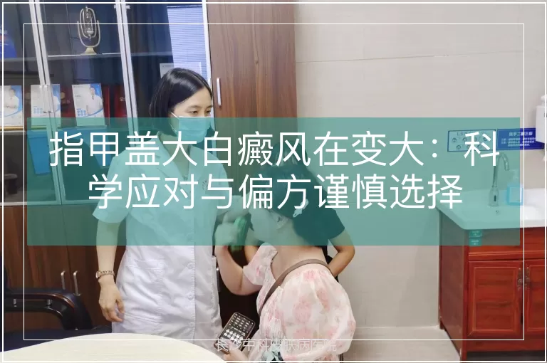指甲盖大白癜风在变大:科学应对与偏方谨慎选择