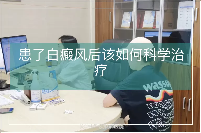 患了白癜风后该如何科学治疗