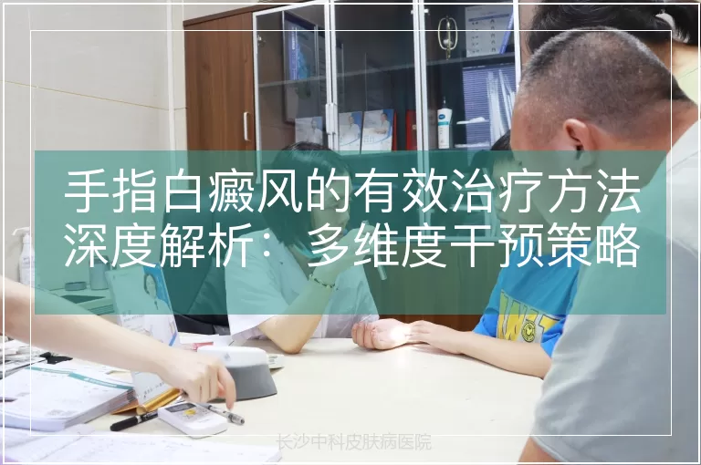 手指白癜风的有效治疗方法深度解析：多维度干预策略与科学管理