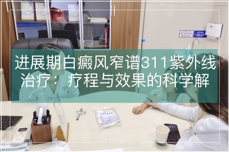 进展期白癜风窄谱311紫外线治疗：疗程与效果的科学解析